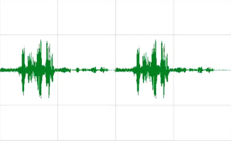 什么是超声波A扫描、超声波C扫描？